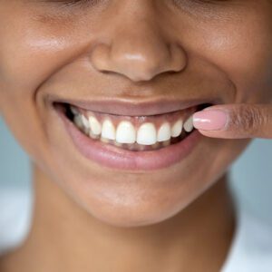 teeth whitening smile makeovers veneers